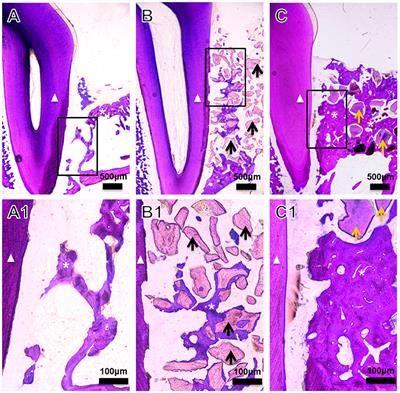 BMP2-Functionalized Biomimetic Calcium Phosphate Graft Promotes Alveolar Defect Healing During <mark class="highlighted">Orthodontic Tooth Movement</mark> in Beagle Dogs